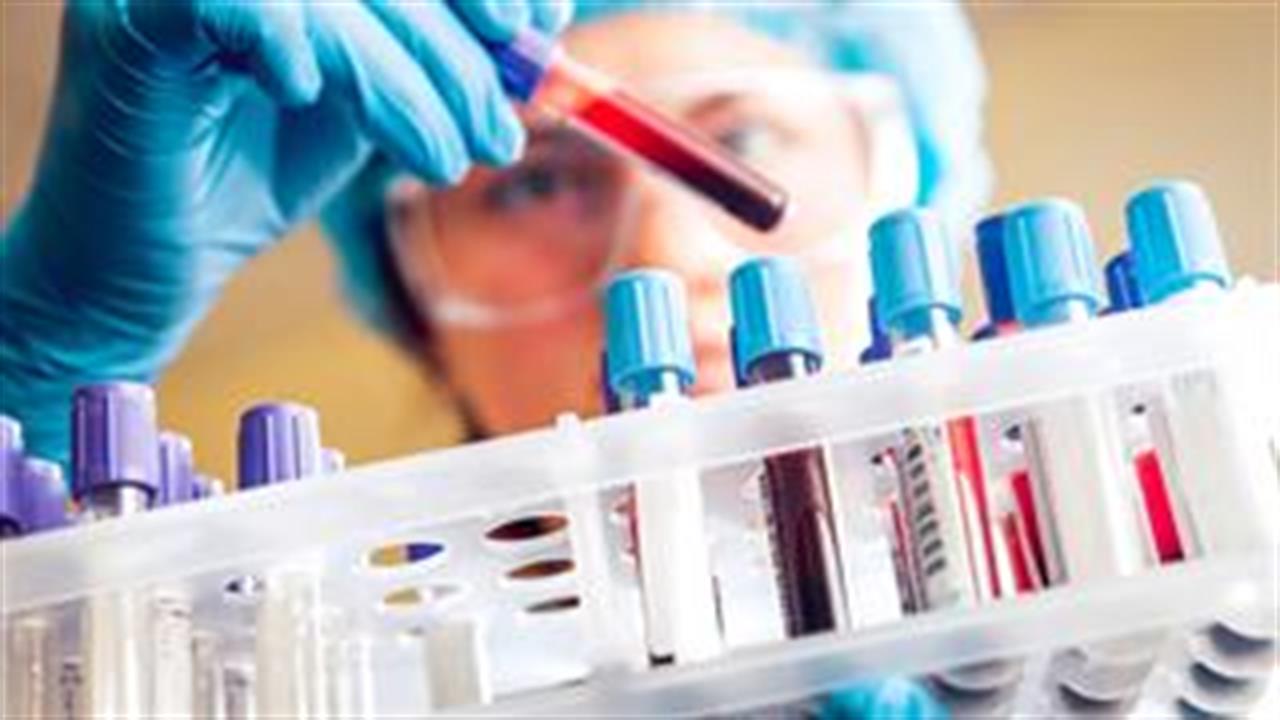 Χρόνια κόπωση: Ποιες εξετάσεις πρέπει να είναι οπωσδήποτε φυσιολογικές