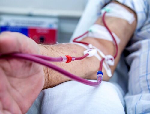 Τι είναι η αιμοκάθαρση – Πώς γίνεται η περιτοναϊκή κάθαρση και η αρτηριακή παράκαμψη