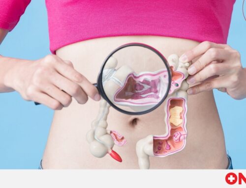 Σε άνοδο οι καρκίνοι του γαστρεντερικού στους νέους